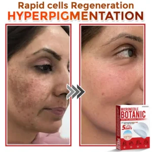 MicroNeedle Botanic Skin Tag Removal Patch - Image 8
