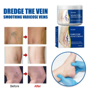 Leg Relief Varicose Veins Cream 50g – Natural Body Care Lotion to Soothe Pain, Reduce Swelling, Improve Circulation & Support Healthy, Comfortable Skin - Image 3