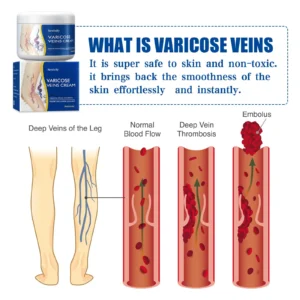 Leg Relief Varicose Veins Cream 50g – Natural Body Care Lotion to Soothe Pain, Reduce Swelling, Improve Circulation & Support Healthy, Comfortable Skin - Image 7