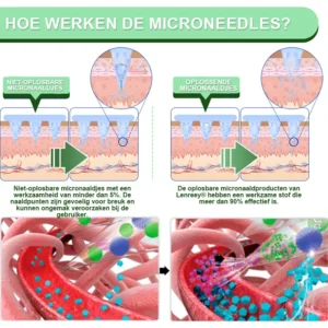 Nano Microneedle Patch - Image 7