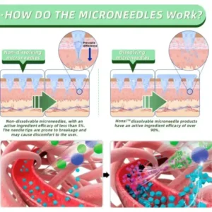 Microneedle Patch - Image 5