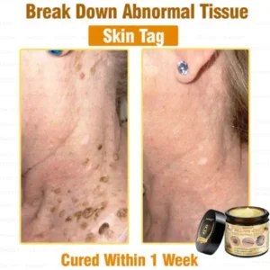7-Day Rapid Skin Rapair Cream US Dermatologist Approved - Image 4