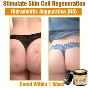 7-Day Rapid Skin Rapair Cream US Dermatologist Approved - Image 6