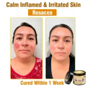 7-Day Rapid Skin Rapair Cream US Dermatologist Approved - Image 8