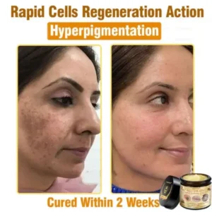 7-Day Rapid Skin Rapair Cream US Dermatologist Approved - Image 9