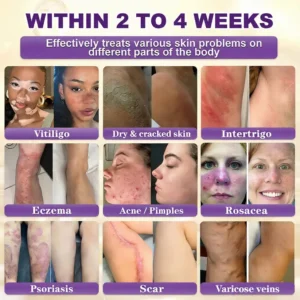 Made and Shipped from Biotin 10-in-1 Skin Restoration Cream - Last Day Promotion: 75% OFF - Image 2