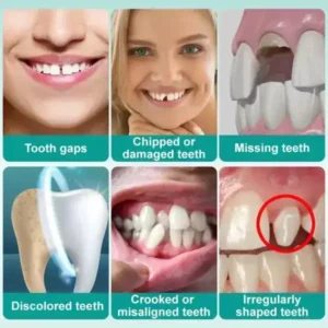 Instant Stick-on Dental Veneers - Image 6
