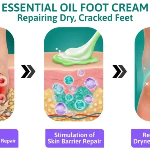 🎁 Limited-Time Offer 🎁 - Don't miss out!Tea Tree Oil Foot Cream (Repairs Dry Cracked Heels, Soothes Tired Feet, Eliminates Odor & Restores Soft Skin) - Image 3