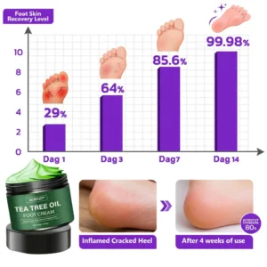 🎁 Limited-Time Offer 🎁 - Don't miss out!Tea Tree Oil Foot Cream (Repairs Dry Cracked Heels, Soothes Tired Feet, Eliminates Odor & Restores Soft Skin) - Image 4