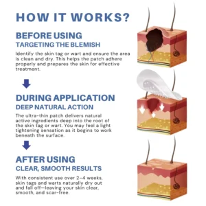 Moles & Warts Removing Skin Tag Patch - Image 4