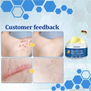 BeeDerm RX Cream - Image 18