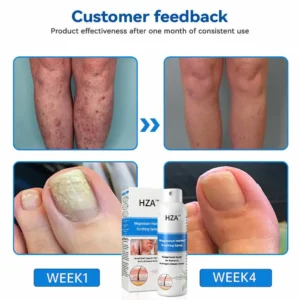Magnesium Herbal Psoriasis Spray - Image 12