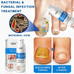 Magnesium Herbal Psoriasis Spray - Image 13