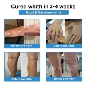✅ Official Store: Nano-Microneedle Joint Patch - Image 5