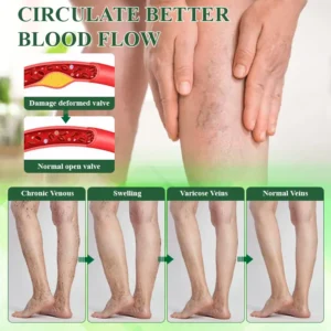 VeinoRoll Therapy Edema Comfort Cream - Image 7