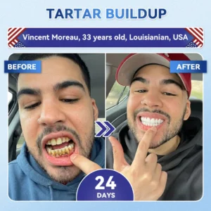 🦷 Tideglusib Fast‑Dissolving Tooth & Gum Repair Oral Strips 😁 (Supports tooth repair and helps relieve gum discomfort and other common oral concerns) - Image 8