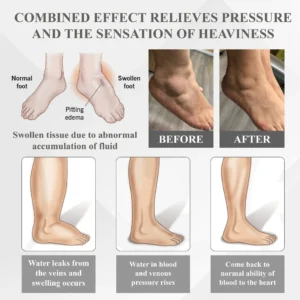 RedHeat EMS EdemaDrain Leg Massager - Image 8