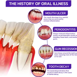 VioGloss Bee Venom Dental Therapy Oral Power🦷 - Image 8