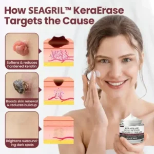 𝐁𝐥𝗮𝐜𝐤 𝐑𝐢𝐜𝗲 𝐒𝐤𝗶𝐧 𝐑𝗲𝐩𝐚𝗶𝐫 𝐄𝐬𝐬𝗲𝐧𝐜𝐞 𝐂𝐫𝗲𝗮𝐦 - Image 3