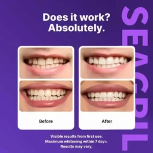 Novora Purple Teeth Whitening Strips - Image 7