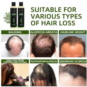 Organic Rosemary Hair Growth Shampoo - Image 7