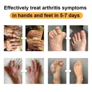 Joint & Bone Pain Foam Spray - Image 7