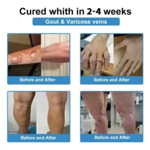 NanoMicroneedle Joint Patch - Image 4