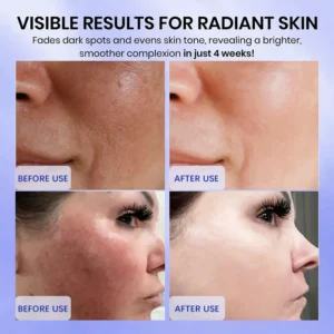 Radiglow Brightening Dark Spot Cream - Image 5