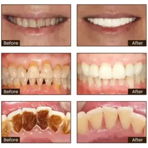 Niacinamide Whitening Toothpaste - Image 14