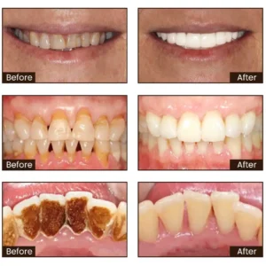 Niacinamide Whitening Toothpaste - Image 14