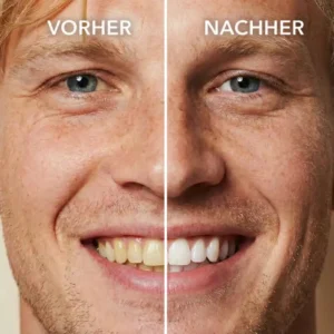 Tooth Whitening Instant Clean Smile - Image 2
