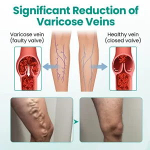 LegRenew Varicose Veins Patch - Image 8