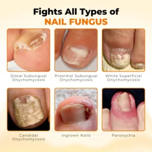 NailRevive Bee Venom Anti-fungi Solution - Image 6