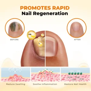 NailRevive Bee Venom Anti-fungi Solution - Image 7