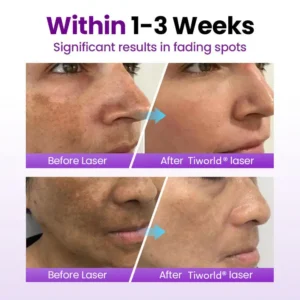 SpotErase Probiotic Shield Serum - Image 10
