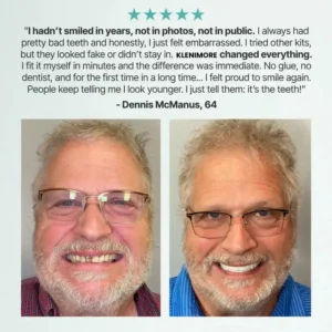 ✨Up to 70% off today Full Denture with Strong Suctiond🦷 - Image 8