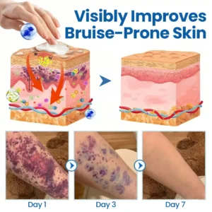 Fragile Skin Repair Cream - Image 8