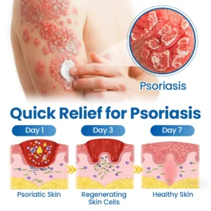 Fragile Skin Repair Cream - Image 9