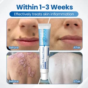Fragile Skin Repair Cream - Image 3