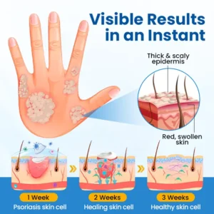 Fragile Skin Repair Cream - Image 7