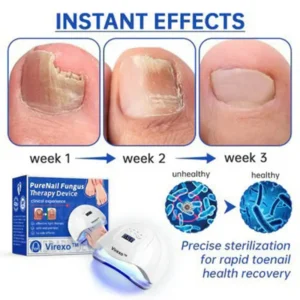 PureNail Fungus Laser Device