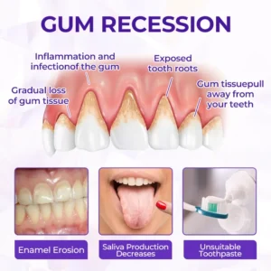 SensiGum Fluoride Toothpaste - Image 7