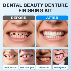 Moldable Dentures – Affordable, Comfortable & Easy At-Home Fit - Image 4