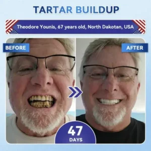 Your Smile~ 🦷 Tideglusib Fast‑Dissolving Tooth & Gum Repair Oral Strips ✨ (𝟓-𝐢𝐧-𝟏 💎 𝐑𝐞𝐛𝐮𝐢𝐥𝐝 𝐄𝐧𝐚𝐦𝐞𝐥 & 𝐃𝐞𝐧𝐭𝐢𝐧 • 𝐒𝐭𝐫𝐞𝐧𝐠𝐭𝐡𝐞𝐧 𝐆𝐮𝐦𝐬 • 𝐄𝐫𝐚𝐝𝐢𝐜𝐚𝐭𝐞 𝐓𝐚𝐫𝐭𝐚𝐫 & 𝐎𝐝𝐨𝐫 • 𝐖𝐡𝐢𝐭𝐞𝐧𝐢𝐧𝐠 • 𝐒𝐭𝐨𝐩 𝐓𝐨𝐨𝐭𝐡 𝐒𝐞𝐧𝐬𝐢𝐭𝐢𝐯𝐢𝐭𝐲) - Image 4