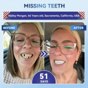 Your Smile~ 🦷 Tideglusib Fast‑Dissolving Tooth & Gum Repair Oral Strips ✨ (𝟓-𝐢𝐧-𝟏 💎 𝐑𝐞𝐛𝐮𝐢𝐥𝐝 𝐄𝐧𝐚𝐦𝐞𝐥 & 𝐃𝐞𝐧𝐭𝐢𝐧 • 𝐒𝐭𝐫𝐞𝐧𝐠𝐭𝐡𝐞𝐧 𝐆𝐮𝐦𝐬 • 𝐄𝐫𝐚𝐝𝐢𝐜𝐚𝐭𝐞 𝐓𝐚𝐫𝐭𝐚𝐫 & 𝐎𝐝𝐨𝐫 • 𝐖𝐡𝐢𝐭𝐞𝐧𝐢𝐧𝐠 • 𝐒𝐭𝐨𝐩 𝐓𝐨𝐨𝐭𝐡 𝐒𝐞𝐧𝐬𝐢𝐭𝐢𝐯𝐢𝐭𝐲) - Image 5