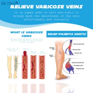 Ricpind MagneticTherapy SwellReduce Acupressure Insoles - Image 7