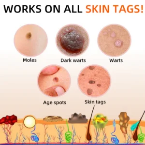 Bee Venom Wart & Tag Removal Cream - Image 9