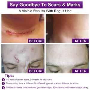 cure FACE & BODY SCAR GEL - Image 7