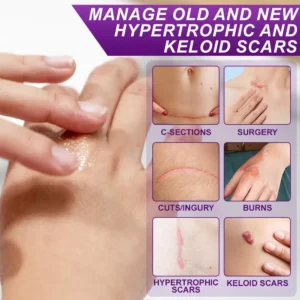 cure FACE & BODY SCAR GEL - Image 8