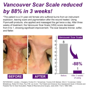 cure FACE & BODY SCAR GEL - Image 2
